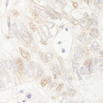 Rabbit APC Antibody