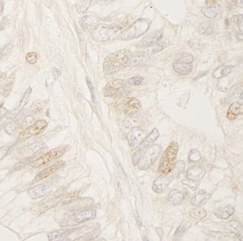 Rabbit APC Antibody