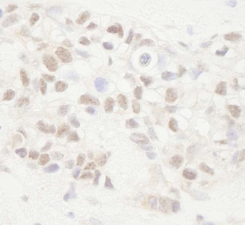 Rabbit APC Antibody
