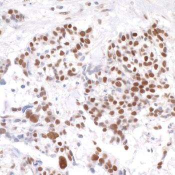 Rabbit Timeless Antibody