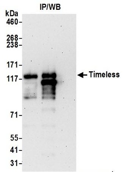 Rabbit Timeless Antibody