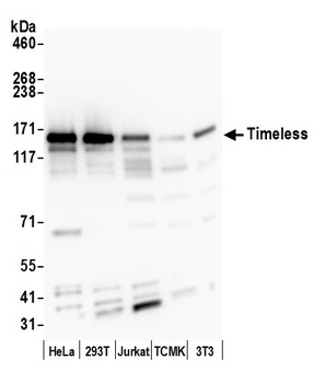 Rabbit Timeless Antibody