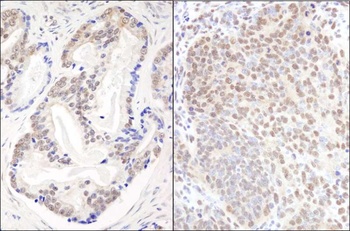 Rabbit EFTUD2/SNRP116 Antibody