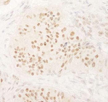 Rabbit KIFC1 Antibody