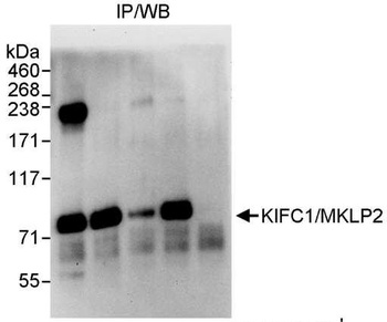 Rabbit KIFC1 Antibody