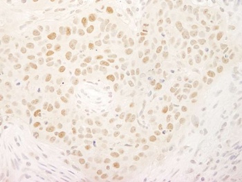 Rabbit KIFC1/MKLP2 Antibody