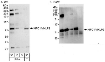 Rabbit KIFC1/MKLP2 Antibody