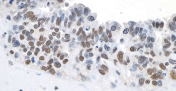 Rabbit Topo II Beta Antibody