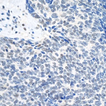 Rabbit Topo II Beta Antibody