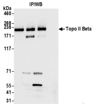 Rabbit Topo II Beta Antibody