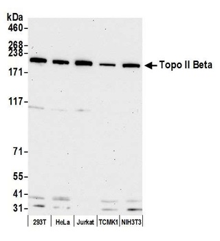 Rabbit Topo II Beta Antibody