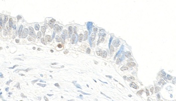 Rabbit Topo II Beta Antibody