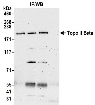 Rabbit Topo II Beta Antibody