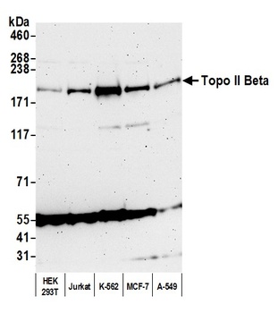 Rabbit Topo II Beta Antibody