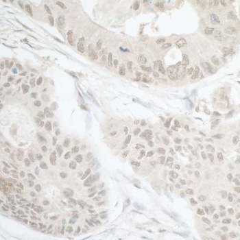 Rabbit DTL/CDT2 Antibody
