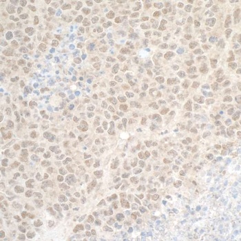 Rabbit DTL/CDT2 Antibody