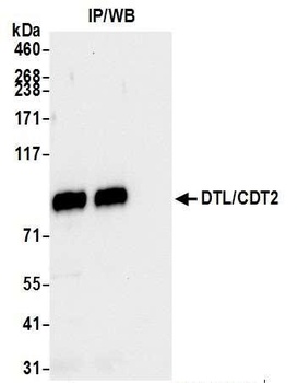 Rabbit DTL/CDT2 Antibody