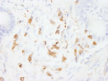 Rabbit Coronin 1 Antibody