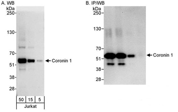 Rabbit Coronin 1 Antibody