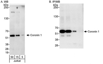 Rabbit Coronin 1 Antibody