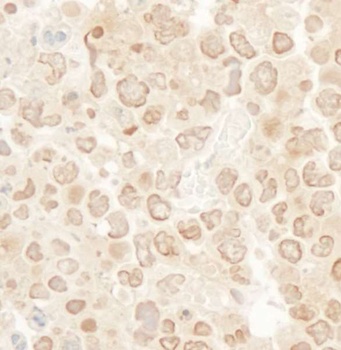 Rabbit MCAK Antibody