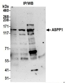 Rabbit ASPP1 Antibody