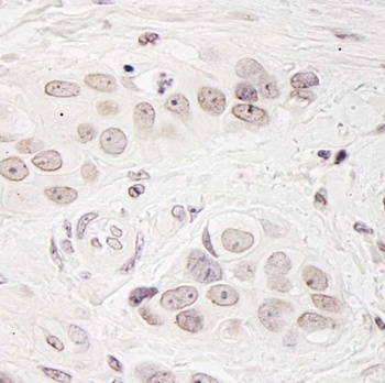 Rabbit BCAS3 Antibody