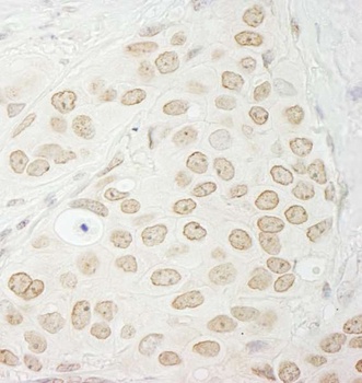 Rabbit PPP1CC Antibody