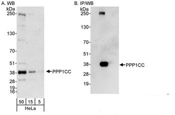 Rabbit PPP1CC Antibody
