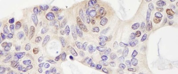 Rabbit USP28 Antibody