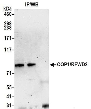 Rabbit COP1/RFWD2 Antibody