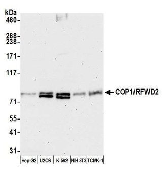 Rabbit COP1/RFWD2 Antibody