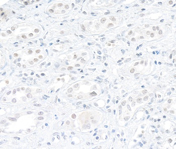 Rabbit anti-DHX9 Antibody