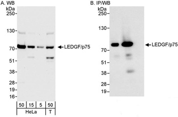 Rabbit LEDGF/p75 Antibody