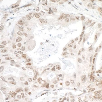Rabbit LEDGF/p75 Antibody
