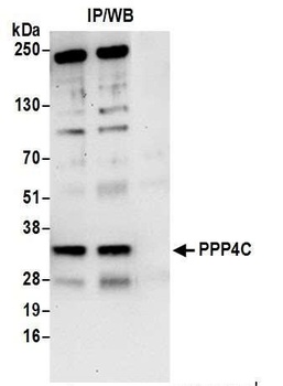 Rabbit PPP4C Antibody