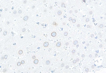 Rabbit TPR Antibody
