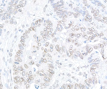 Rabbit TPR Antibody