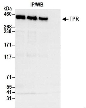 Rabbit TPR Antibody