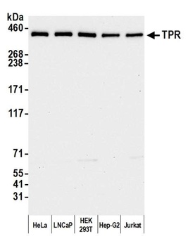 Rabbit TPR Antibody