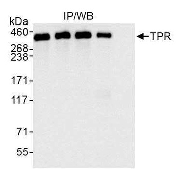 Rabbit TPR Antibody