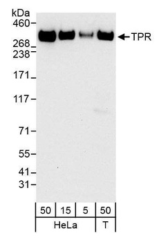 Rabbit TPR Antibody