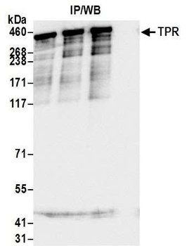 Rabbit TPR Antibody