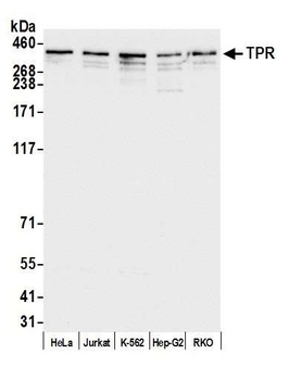 Rabbit TPR Antibody