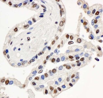 Rabbit BAF57/SMARCE1 Antibody