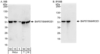 Rabbit BAF57/SMARCE1 Antibody