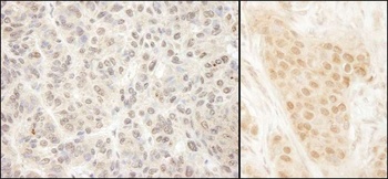 Rabbit MCAK Antibody