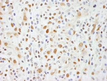Rabbit NIF1 Antibody