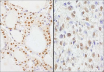 Rabbit NIF1 Antibody