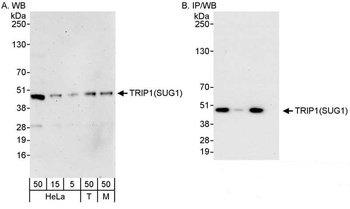 Rabbit TRIP1/SUG1 Antibody